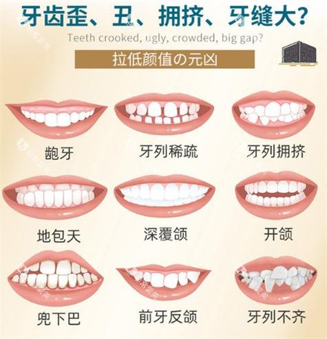 矫正牙齿贴片是起到什么作用_矫正牙齿贴片多少钱_牙齿矫正贴片钱怎么拿