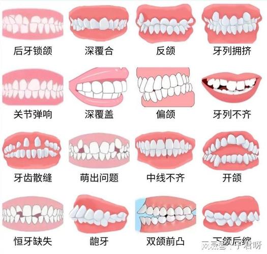 儿童牙齿矫正一般价格多少？带娃整牙到底花几万