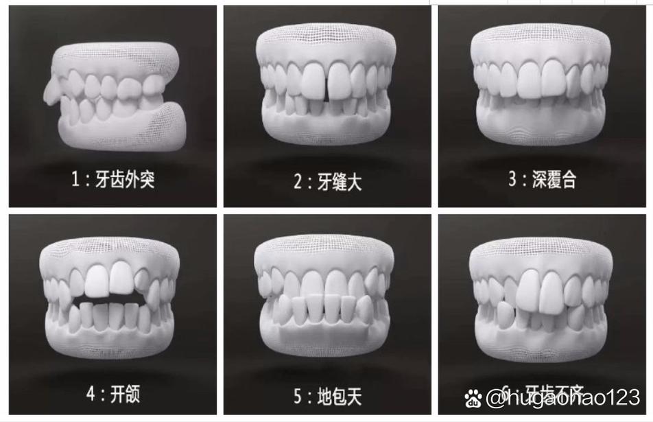 30岁矫正牙齿有什么危害_牙齿矫正有危害吗_牙齿矫正危害有什么