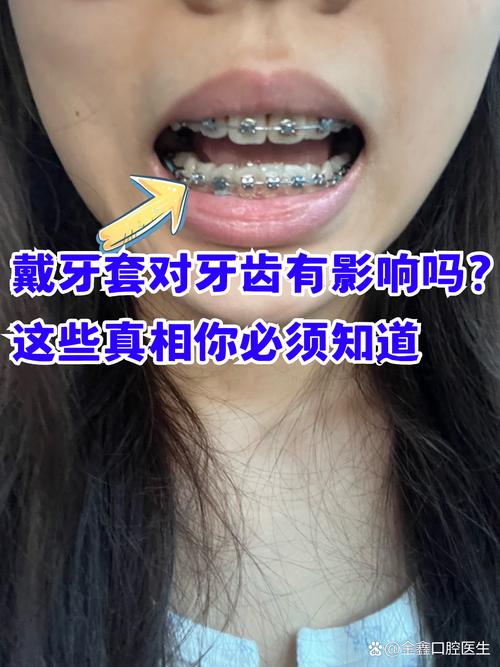 成人矫正牙齿口腔值得做吗 这些真相医生不会主动说
