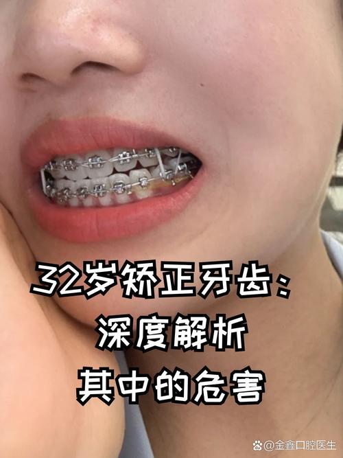 28岁做牙齿矫正晚不晚？关键看这几点