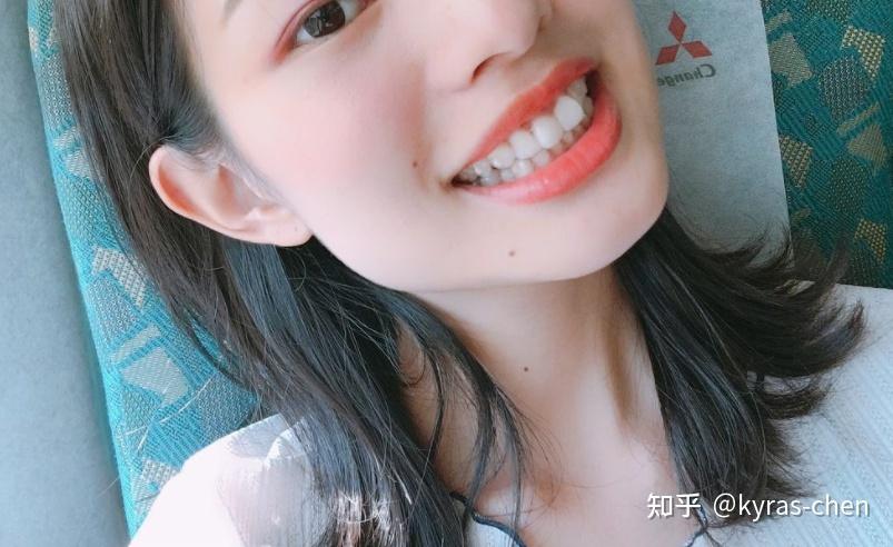 成人门牙不齐矫正真的很简单吗