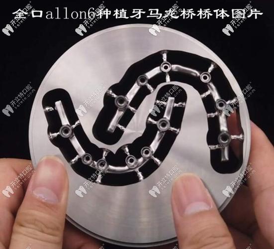 深圳半口All-on-4种植牙医院怎么选？地址与避坑指南