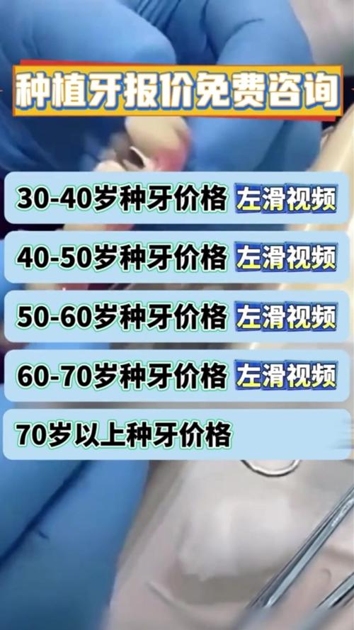 南充半口种牙到底要花多少钱？2026年真实报价揭秘