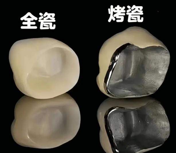 南京种牙多少钱_南京种牙价格表2023年_南京现在种牙一颗多少钱