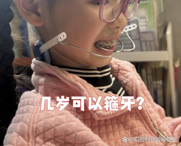 11岁可以矫正牙齿吗_牙齿矫正可以改变脸型吗_牙齿矫正可以只做上排牙吗
