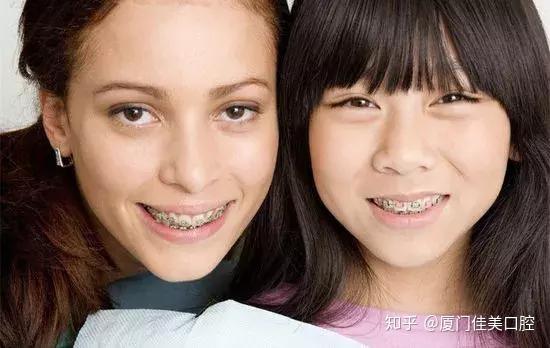 鄂尔多斯牙齿矫正贵吗_鄂尔多斯牙齿矫正哪个医院好_鄂尔多斯种植牙