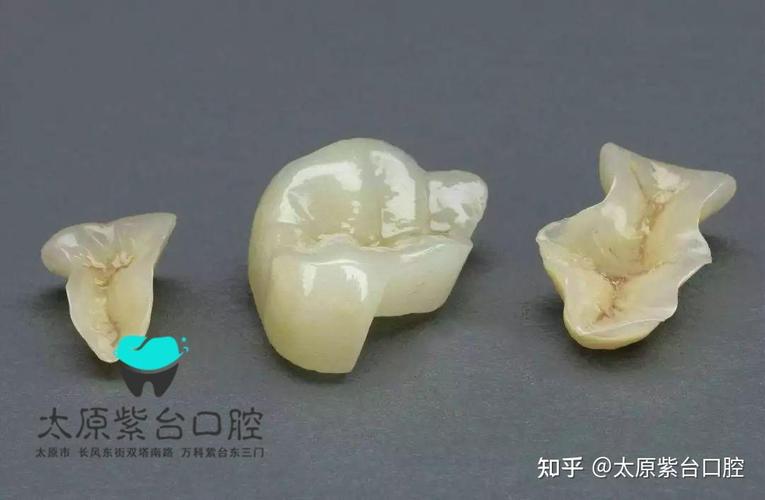 口腔检查反馈单看不懂？3步教你秒读