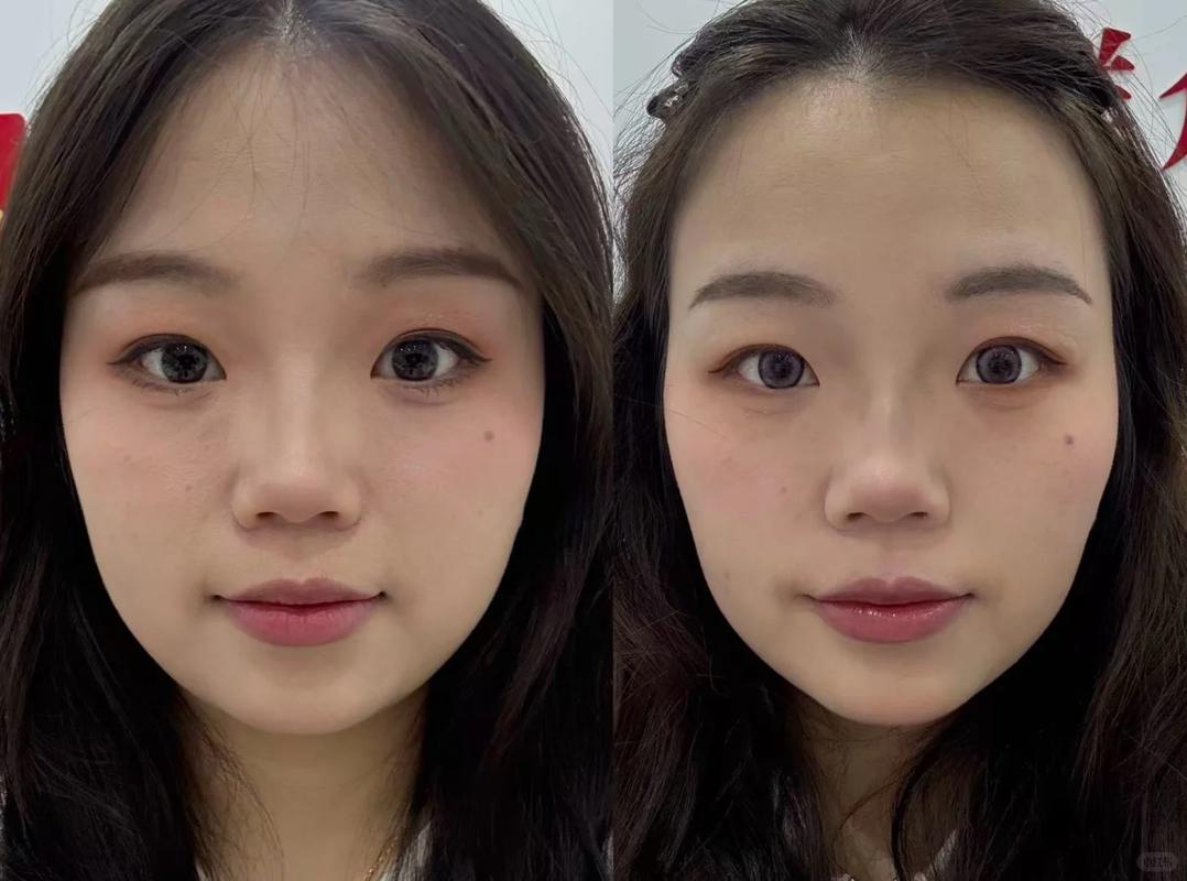 牙齿矫正年龄多少合适_矫正牙齿有年龄_牙齿矫正年龄大了会松动吗