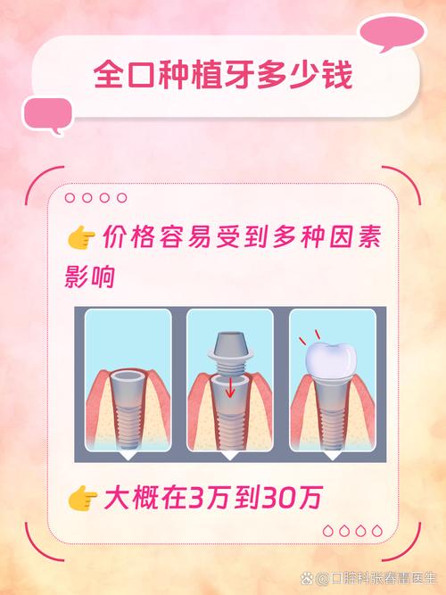 种植满口牙大概需要多少天_牙齿种植满口牙_满口牙种植