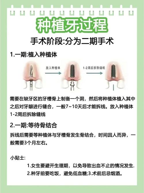 安种植牙的利弊_牙种植好不好_牙种植的危害