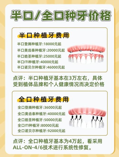 2026上海半口全口种植牙集采后多少钱