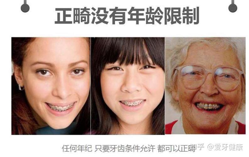 35岁了牙齿还能矫正么_牙齿矫正还能当兵吗_牙齿矫正还能戴颚垫吗