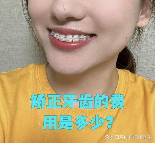 纠正牙型费用全解析：矫正牙齿一般要多少钱