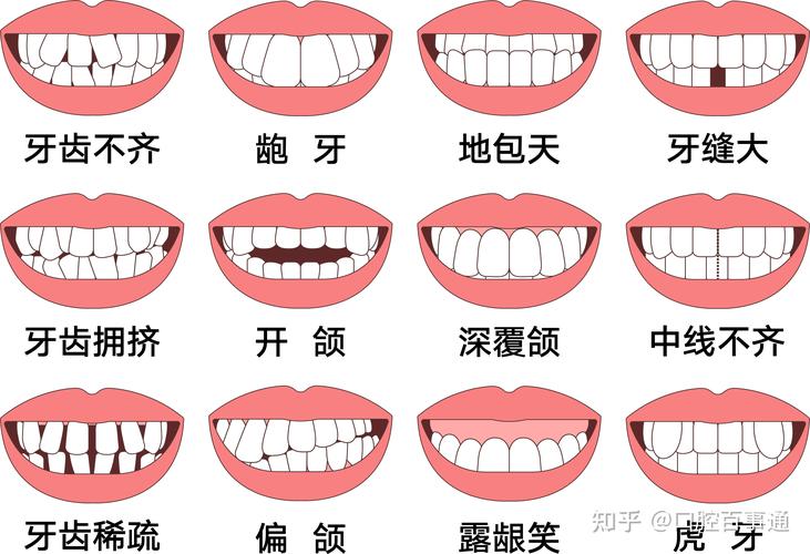 25岁矫正牙齿还来得及吗真实经历分享