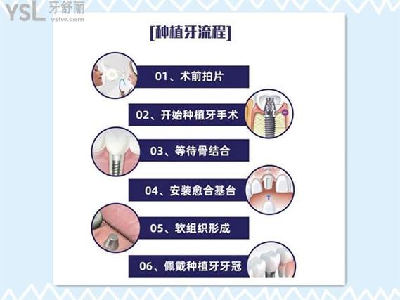 咸宁牙齿种植_牙齿种植_牙齿种植价钱