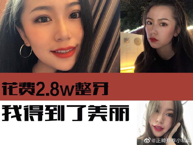 40岁矫正牙齿多少钱_牙齿矫正钱交了不给退怎么办_牙齿矫正钱要一次性付完吗