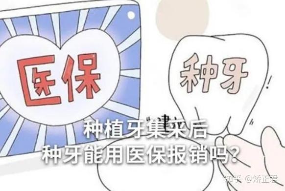 报销医保牙能种植深圳用吗_深圳种牙可以用医保账户余额吗_深圳种植牙能用医保报销吗