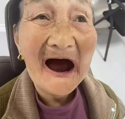 牙齿合适种植什么_牙齿合适种植牙吗_74岁种植牙齿合适吗