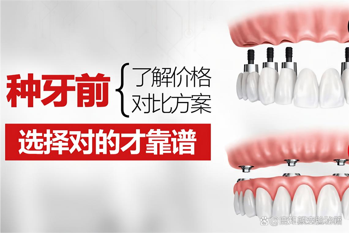 武威市牙齿矫正_武威矫正牙齿的费用是多少_武威牙齿矫正医院排名