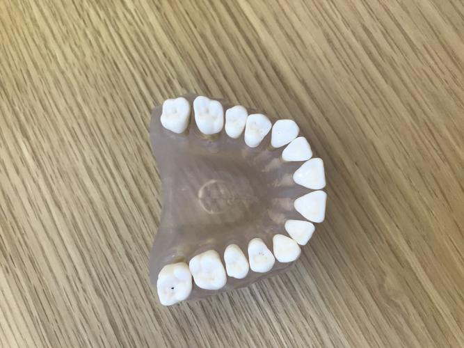 瑞典诺贝尔种植牙好不好？进口高端植体价格1.5万起