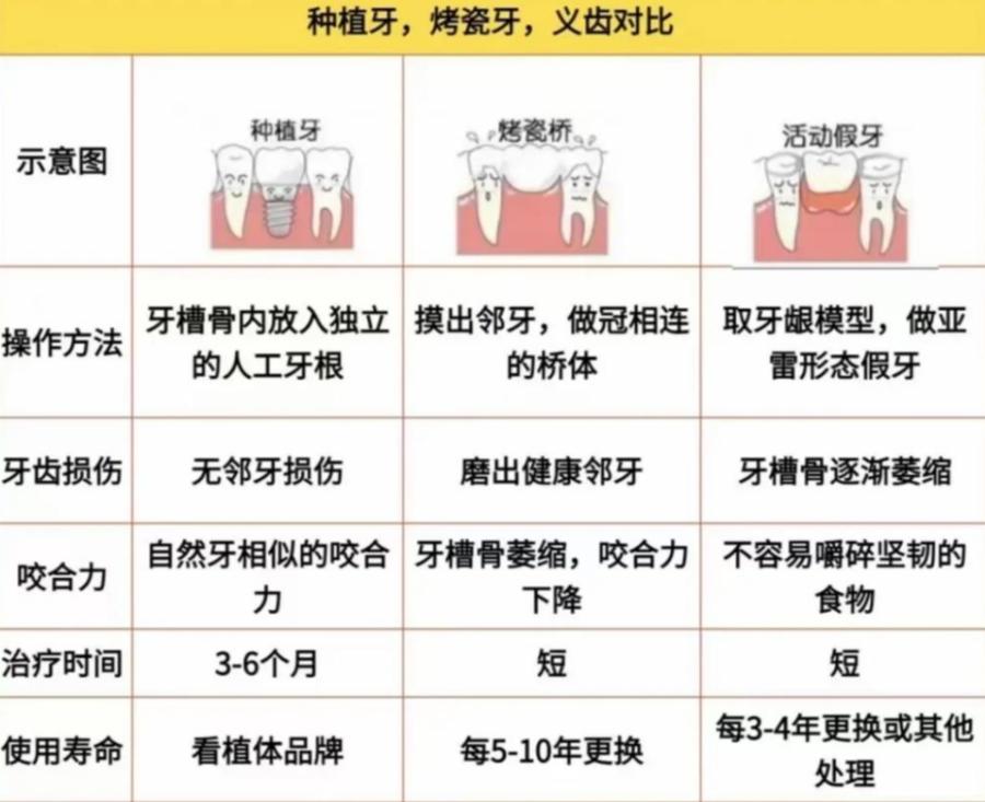 2万块种牙到底够不够 真实费用全解析