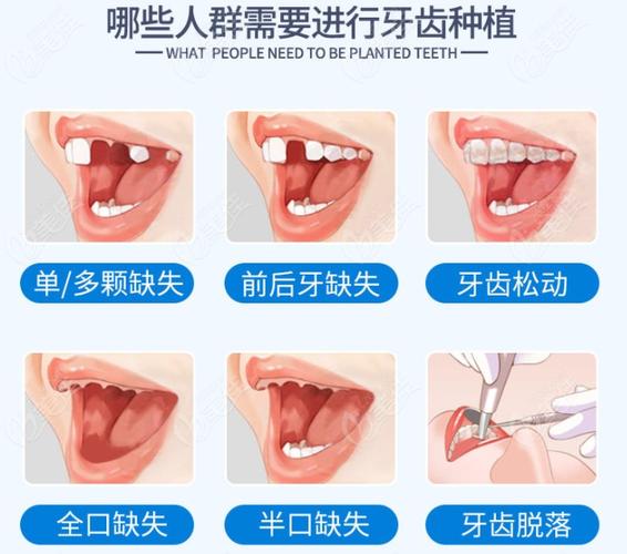 保定口腔医院收费多少钱？看牙项目全解析