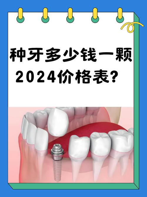 东莞种植牙收费标准_东莞牙齿的种植费用_牙齿种植东莞费用多少