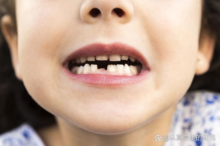 8岁孩子牙齿矫正哪种方法好