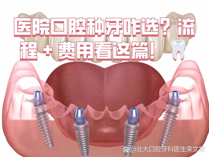 深圳连锁牙科种牙贵不贵？值不值得选？