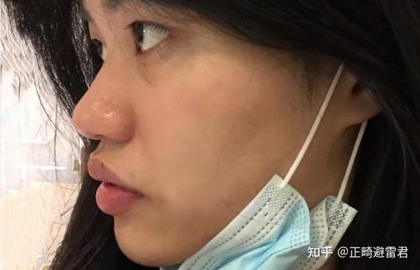 成人牙齿矫正可以吗_成人牙齿矫正可以报医保吗_成人可以矫正牙齿么