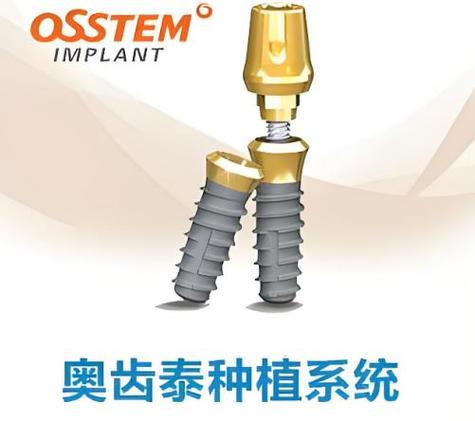 奥齿泰种植体7800贵吗_奥齿泰牙齿种植体_奥齿泰种植体能用多久