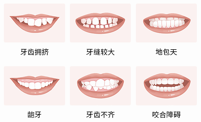 盐城牙齿矫正收费标准_盐城矫正牙齿哪个医院好_盐城牙齿整形医院