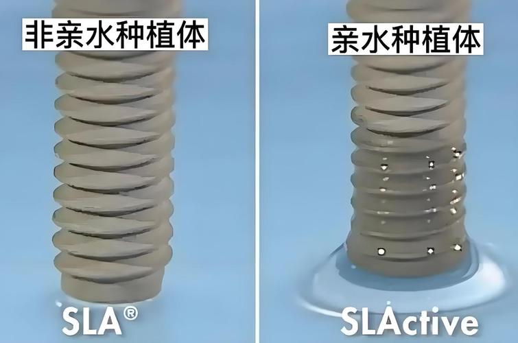 牙齿种植钱现在多少钱_现在种植一颗牙齿多少钱_牙齿种植费用