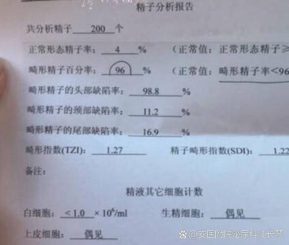 无精症和染色体有关系吗_精原细胞染色体核型_精原细胞有几条染色体