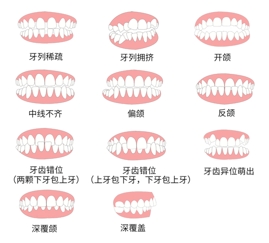 30岁做牙齿矫正到底值不值 利与弊全分析