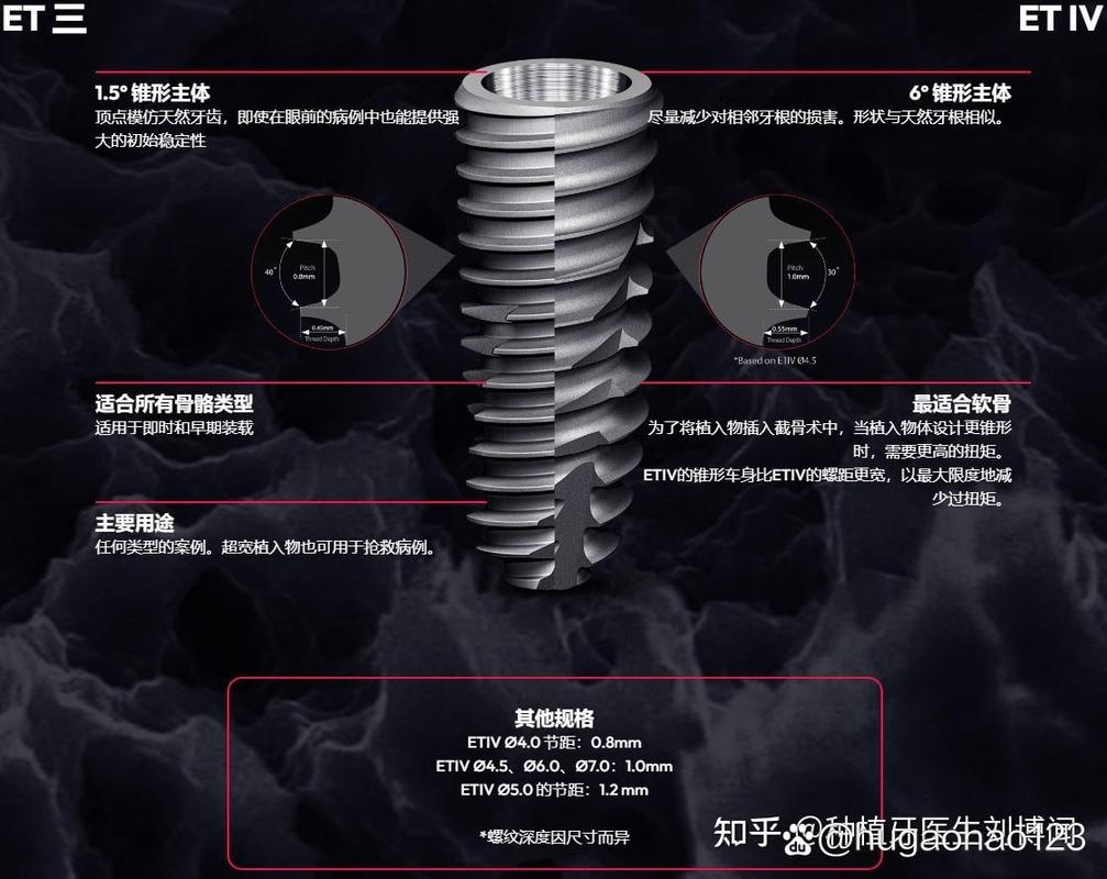皓圣种植牙一般能用多少年_皓圣美牙科种植体价格_深圳皓圣种植牙医院推荐