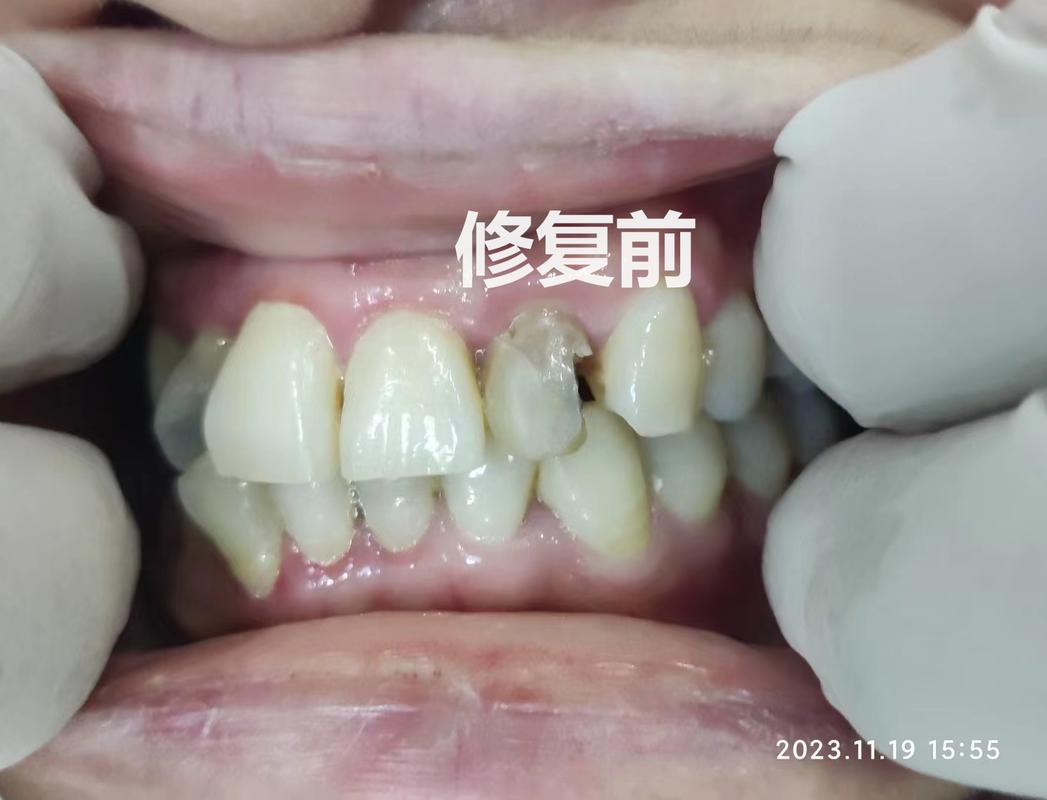 牙齿矫正费用北京口腔医院_北京牙齿矫正正规口腔机构_口腔牙齿矫正正规机构北京