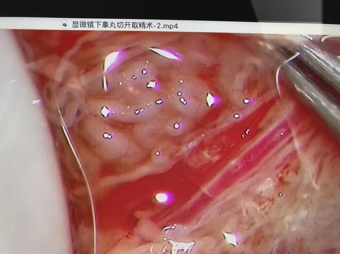无精症能不能生孩子_有精神病能生孩子吗女性_无精能生孩子吗