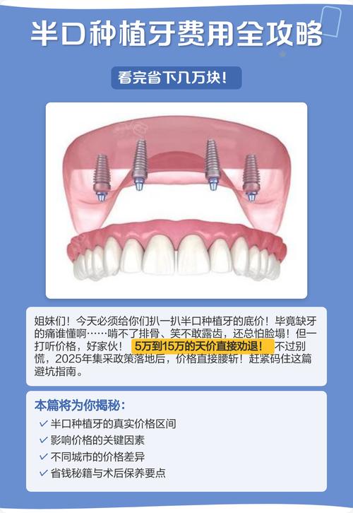 牙种植口价格比较高的原因_种植牙口腔多少钱_半口种植牙价格比较