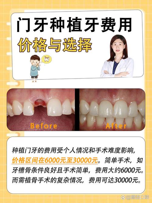 门牙掉了能做种植牙吗？条件费用一次说清