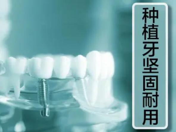 安卓健种植一颗牙一般多少钱_安卓健种植牙11000贵吗_种植牙安卓健的品种
