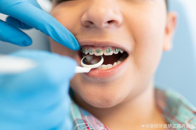 8岁孩子门牙龅牙矫正方法 儿童早期干预怎么做
