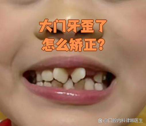 成年反弹牙齿矫正人会怎么样_成人矫正牙齿反弹怎么办_成年人矫正牙齿反弹