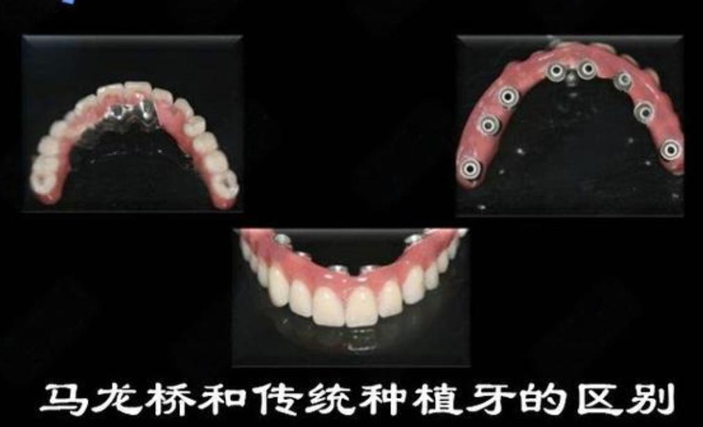 大同种牙哪里好 选公立还是私立更靠谱