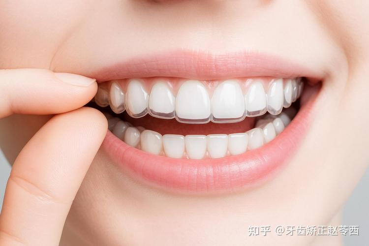 白山做牙齿矫正去什么医院_白山市牙科最好的_牙齿矫正白山医院做去哪家好
