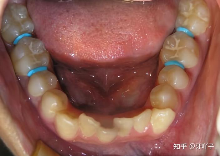 方得人心的意思_玉林牙齿矫正效果怎么样_一亩桃树能产多少桃胶