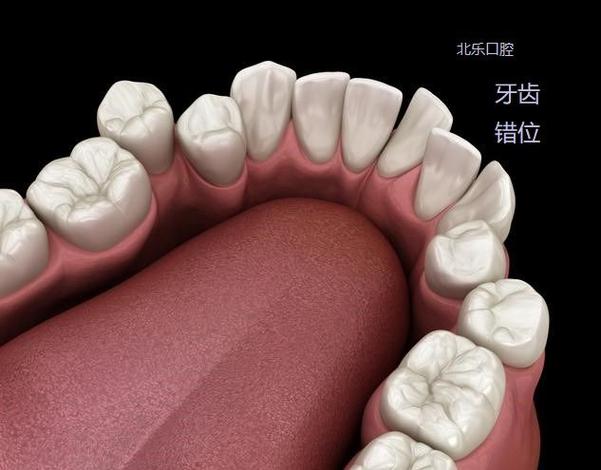 35岁了牙齿还可以矫正吗_牙齿矫正可以医保报销吗_牙齿矫正可以只矫正几颗吗