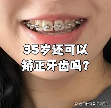牙齿矫正可以只矫正几颗吗_牙齿矫正可以医保报销吗_35岁了牙齿还可以矫正吗