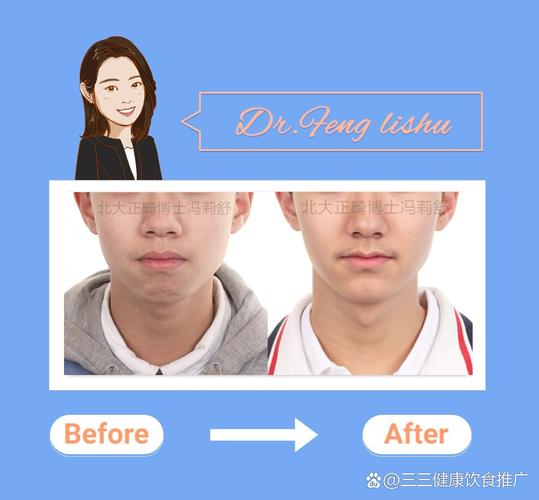 牙齿矫正下巴后缩需要多长时间_缩下巴牙齿矫正改变可以后移吗_矫正牙齿可以改变下巴后缩吗